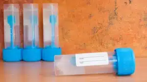 דם סמוי בצואה חיובי